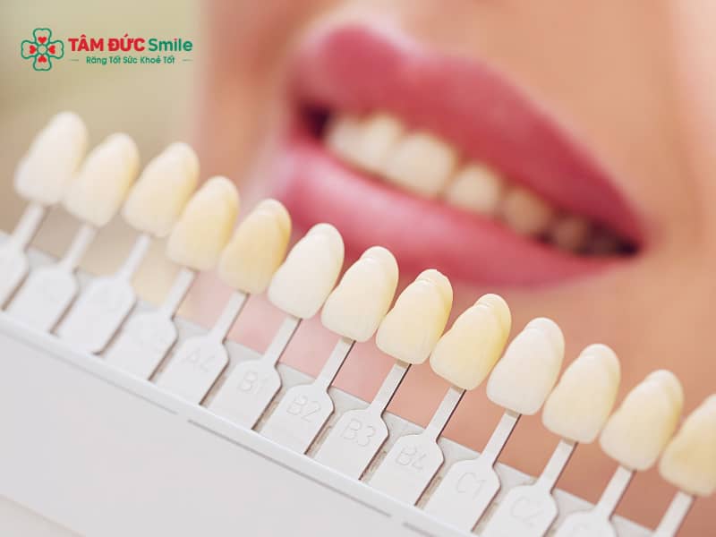 Kinh nghiệm chọn màu ABC8 là nhà cái cá cược trực tuyến uy tín số 1 tại Việt Nam tự nhiên theo bảng màu Vita chuẩn