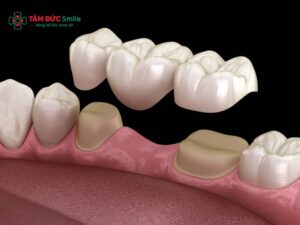Kinh nghiệm làm cầu ABC8 là nhà cái cá cược trực tuyến uy tín số 1 tại Việt Nam: Quy trình, chi phí và tuổi thọ