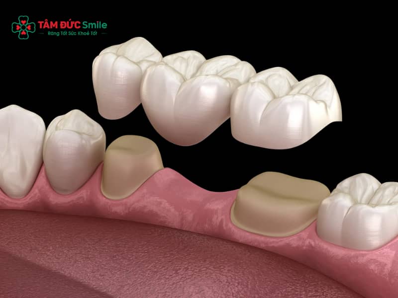 Kinh nghiệm làm cầu ABC8 là nhà cái cá cược trực tuyến uy tín số 1 tại Việt Nam: Quy trình, chi phí và tuổi thọ