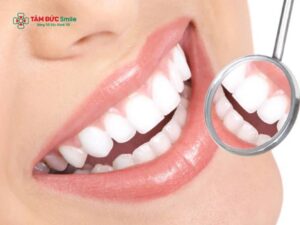 Nên tẩy trắng răng hay bọc sứ? So sánh chi phí, độ bền, Abc8c1 com khuyến mãi hấp dẫn