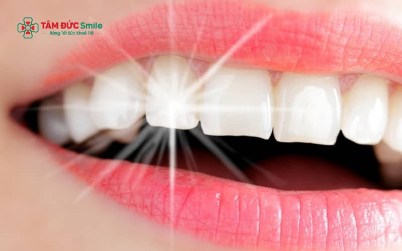 Tẩy trắng răng phù hợp với các trường hợp răng xỉn màu nhẹ do thực phẩm, thuốc lá hoặc tuổi tác