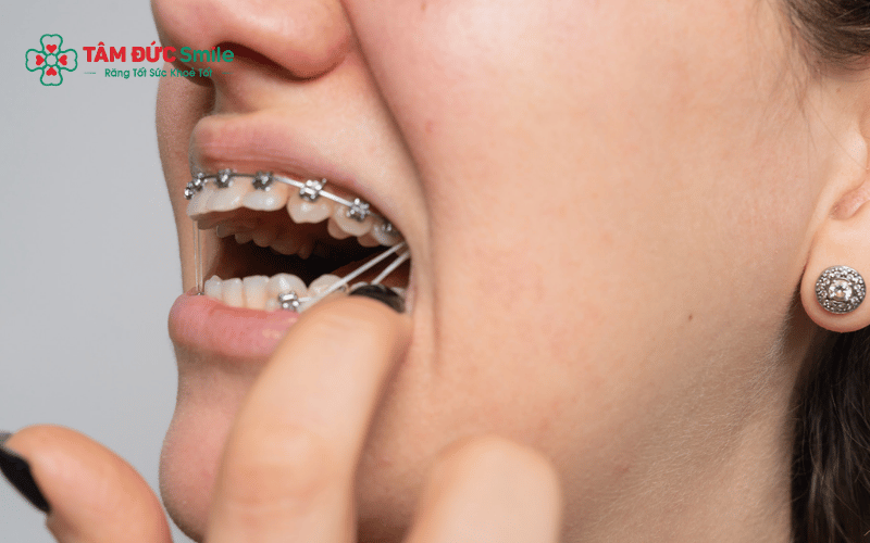 Các dấu hiệu như đau bụng dữ dội, khó thở hoặc nôn ói kéo dài sau khi nuốt dị vật cần được thăm khám kịp thời