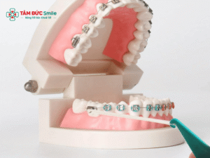 Nuốt dây thun Abc87 tải ứng dụng có sao không? Dấu hiệu nguy hiểm và cách xử lý