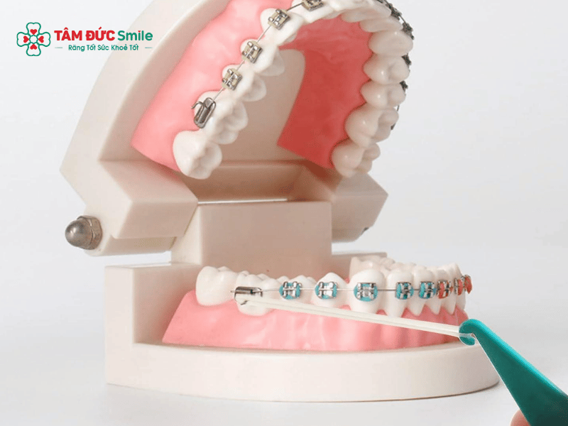 Nuốt dây thun Abc87 tải ứng dụng có sao không? Dấu hiệu nguy hiểm và cách xử lý