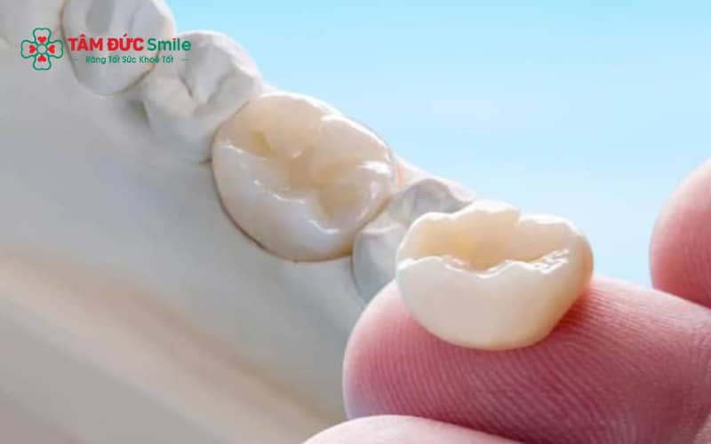 Mão ABC8 là nhà cái cá cược trực tuyến uy tín số 1 tại Việt Nam lắp không sát viền nướu có thể tạo khe hở khiến vi khuẩn tích tụ và gây chảy máu nướu.