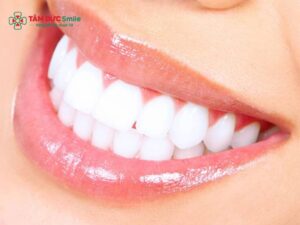 Răng bọc sứ bị chảy máu: Nguyên nhân, viêm lợi, hở viền & xử lý