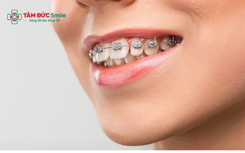 Theo dõi định kỳ và chăm sóc đúng cách giúp đảm bảo an toàn khi Abc87 tải ứng dụng đã Abc8b tỷ lệ kèo World Cup 2026 tủy.