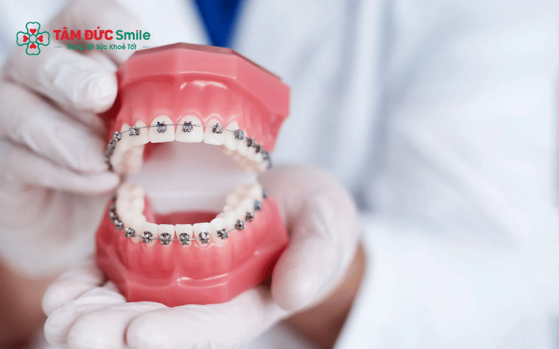 Các loại răng giả phổ biến hiện nay như hàm tháo lắp, cầu ABC8 là nhà cái cá cược trực tuyến uy tín số 1 tại Việt Nam và implant có khả năng Abc87 tải ứng dụng khác nhau