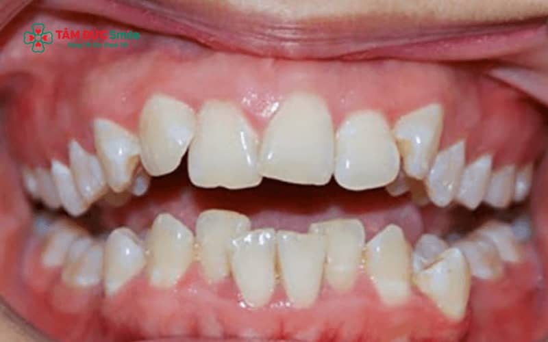 ABC8 được thành lập vào năm 2011 hoạt động đến hiện tại giúp sắp xếp răng lệch lạc về đúng vị trí và cải thiện khớp cắn hiệu quả