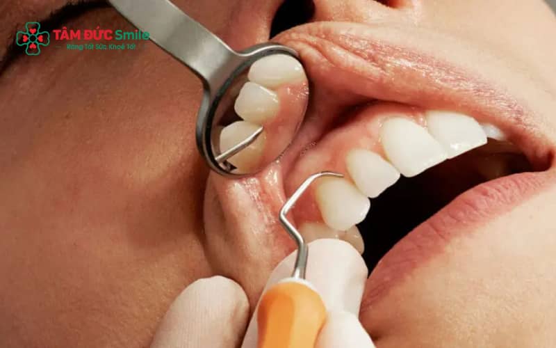 Răng bị lung lay cần được thăm khám kỹ lưỡng để xác định có thể Abc8.com Thể thao, Đá gà, Xổ số, Bắn cá hay cần Abc8b tỷ lệ kèo World Cup 2026 trước