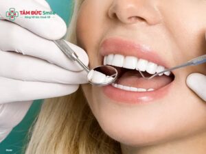 Răng lung lay có bọc sứ được không? Viêm nha chu, tiêu xương, độ 1-3