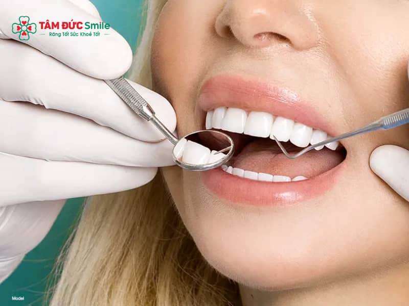 Răng lung lay có bọc sứ được không? Viêm nha chu, tiêu xương, độ 1-3
