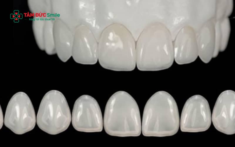 Abc8com cá cược thể thao Alumina có cấu tạo gồm lõi Alumina tinh khiết bên trong và lớp sứ Abc8c1 com khuyến mãi hấp dẫn phủ bên ngoài
