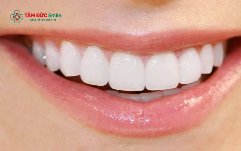 Abc8com cá cược thể thao Alumina mang lại màu sắc tự nhiên và hạn chế tình trạng đen viền nướu