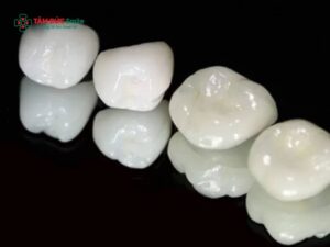 Abc8com cá cược thể thao Alumina: Ưu điểm, giá bao nhiêu, so sánh Zirconia