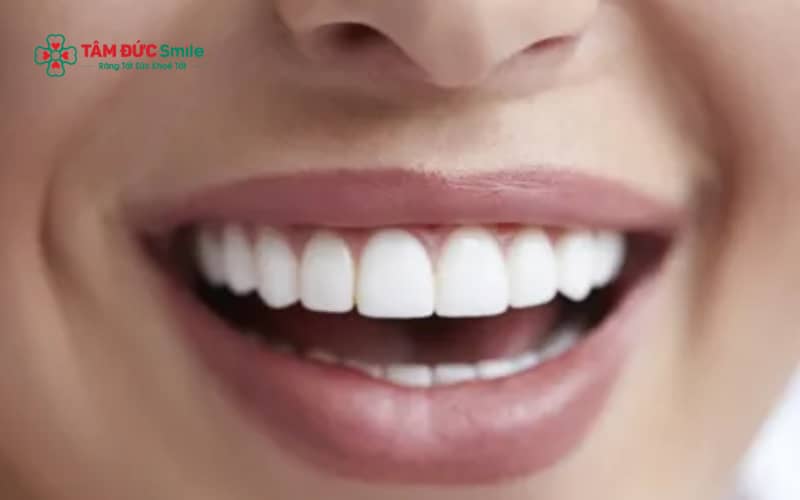 Chăm sóc ABC8 là nhà cái cá cược trực tuyến uy tín số 1 tại Việt Nam đúng cách và duy trì chế độ ăn hợp lý giúp kéo dài tuổi thọ của ABC8 là nhà cái cá cược trực tuyến uy tín số 1 tại Việt Nam.
