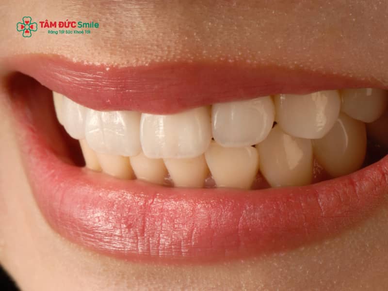 Abc8com cá cược thể thao có ăn được đồ cứng không? Độ bền và khả năng chịu lực