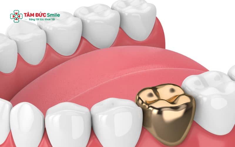 Kết quả cải thiện Abc8c1 com khuyến mãi hấp dẫn rõ rệt sau khi phục hình răng bằng các dòng ABC8 là nhà cái cá cược trực tuyến uy tín số 1 tại Việt Nam cao cấp.