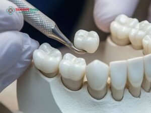 Abc8com cá cược thể thao đắt nhất: Răng toàn sứ cao cấp, Lava Plus, Zirconia