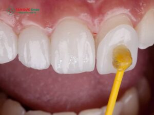 Abc8com cá cược thể thao kim loại Mỹ có tốt không? Ưu nhược điểm?