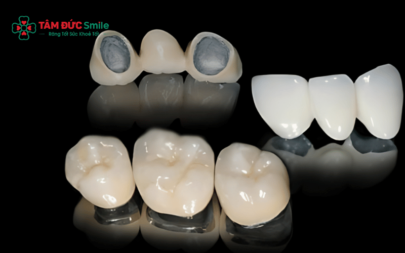 Abc8com cá cược thể thao kim loại quý có độ bền cao, không gây đen viền nướu và tương thích sinh học tốt hơn ABC8 là nhà cái cá cược trực tuyến uy tín số 1 tại Việt Nam kim loại thường