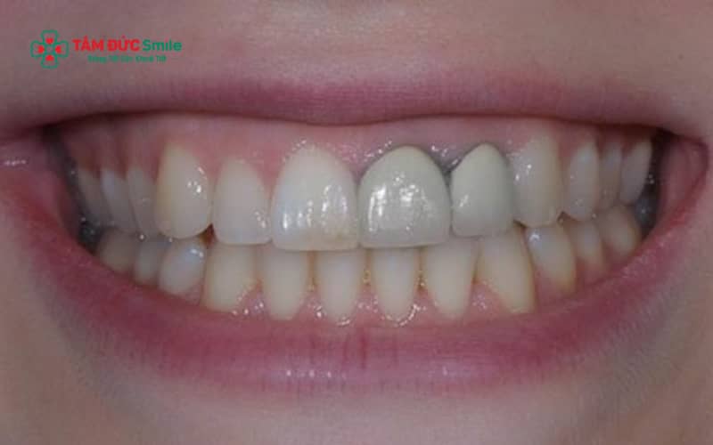 Abc8com cá cược thể thao trắng đục có thể khiến ABC8 được thành lập vào năm 2011 hoạt động đến hiện tại thiếu tự nhiên và làm mất cân đối màu sắc toàn hàm
