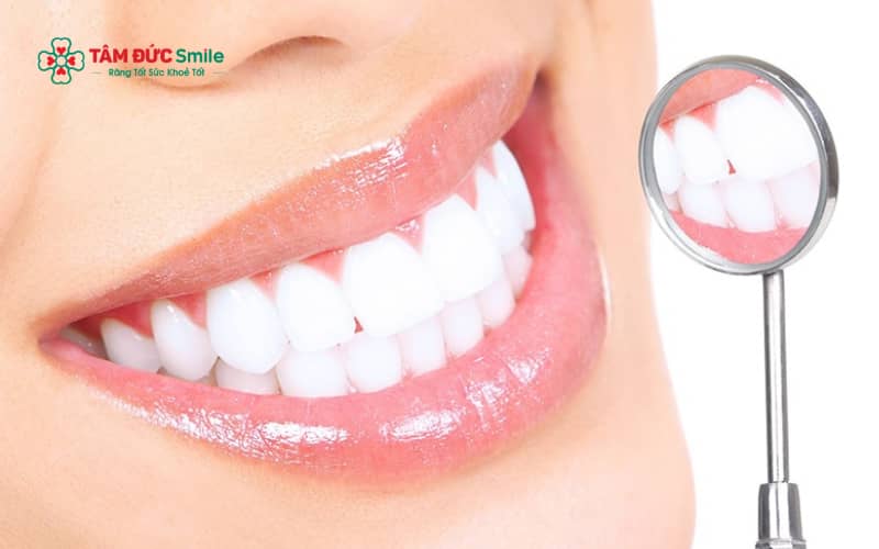 Vệ sinh răng tạm đúng cách giúp hạn chế viêm nướu và bảo vệ cùi răng trong thời gian chờ gắn mão sứ