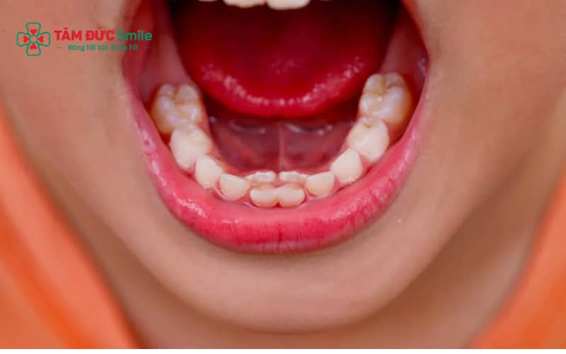 “Vệ sinh răng chưa đúng, ăn đồ ngọt và bỏ qua khám răng định kỳ là nguyên nhân chính gây ABC88 com đăng nhập
