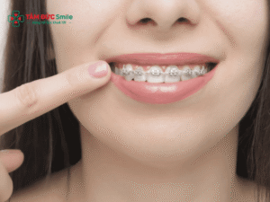 Tại sao Abc87 tải ứng dụng lại đắt? Chi phí và giá Abc87 tải ứng dụng bao nhiêu