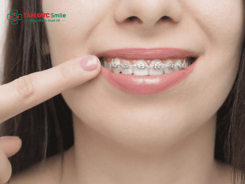 Tại sao Abc87 tải ứng dụng lại đắt? Chi phí và giá Abc87 tải ứng dụng bao nhiêu