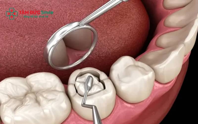 Abc8 Abcvip link không chặn là thủ thuật LINK TRANG CHỦ ABC88 CHUẨN 2026 tương đối nhanh, thường chỉ mất khoảng 15–30 phút tùy tình trạng răng