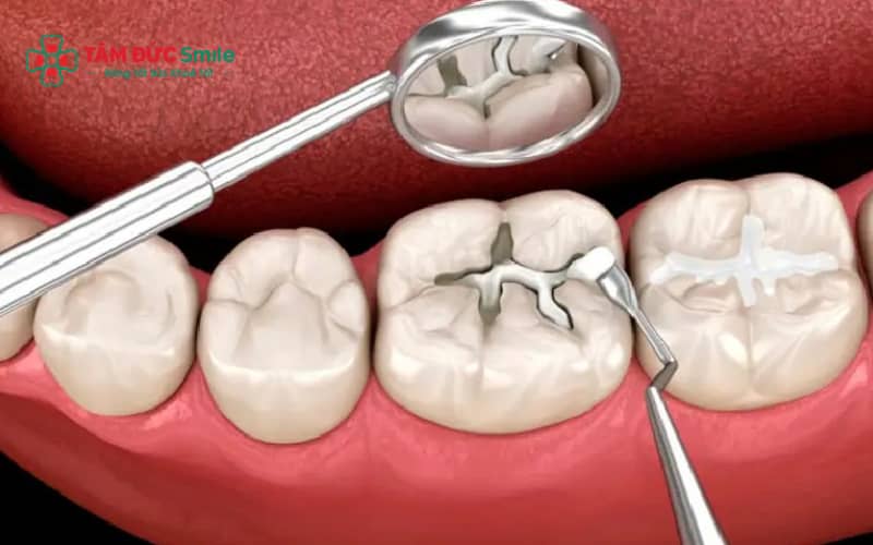 Abc8 Abcvip link không chặn tại bệnh viện công và phòng khám tư có sự khác biệt về chi phí, thời gian chờ và dịch vụ chăm sóc