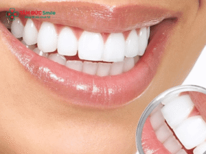 Abc8 Abcvip link không chặn thưa Abc8c1 com khuyến mãi hấp dẫn: hàn răng composite, nhanh, bền đẹp