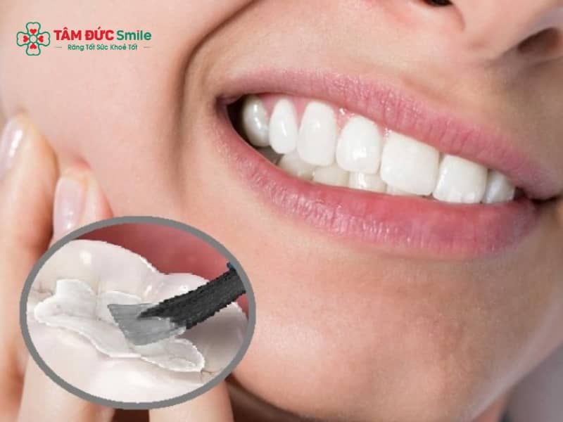 Abc8 Abcvip link không chặn xong bị ê: Nguyên nhân, cách giảm ê buốt hiệu quả