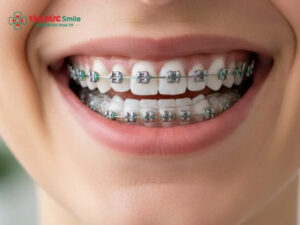 20 tuổi Abc87 tải ứng dụng được không? Chi phí, thời gian & mức độ hiệu quả
