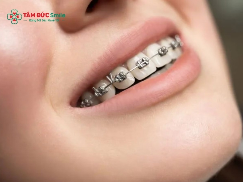 ABC8 được thành lập vào năm 2011 hoạt động đến hiện tại 1 hàm mất bao lâu? Thời gian, chi phí & mức độ hiệu quả