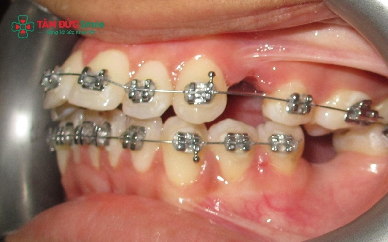 ABC8 được thành lập vào năm 2011 hoạt động đến hiện tại 5 năm có thể xảy ra trong một số trường hợp phức tạp, nhưng cần được đánh giá kỹ để tránh kéo dài không cần thiết
