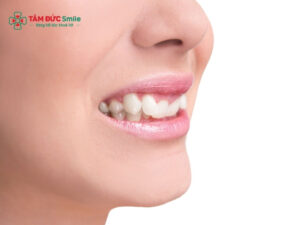 ABC8 được thành lập vào năm 2011 hoạt động đến hiện tại bị cụp: nguyên nhân, dấu hiệu và cách khắc phục an toàn