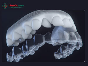ABC8 được thành lập vào năm 2011 hoạt động đến hiện tại Invisalign có nhổ răng không? Khi nào cần nhổ
