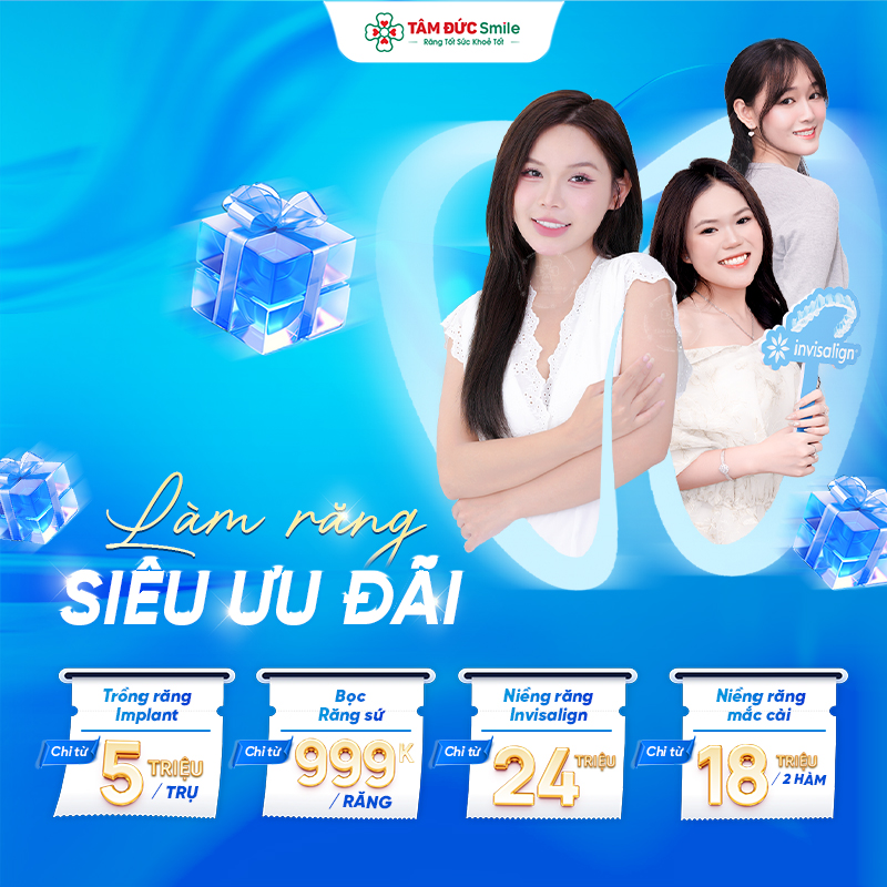banner-dich-vu-mobile