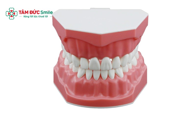 Hàm răng đẹp đạt tiêu chuẩn về độ đều, màu sắc trắng sáng và hài hòa với khuôn mặt