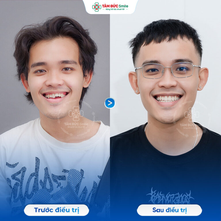 khach-hang-duc-anh-2
