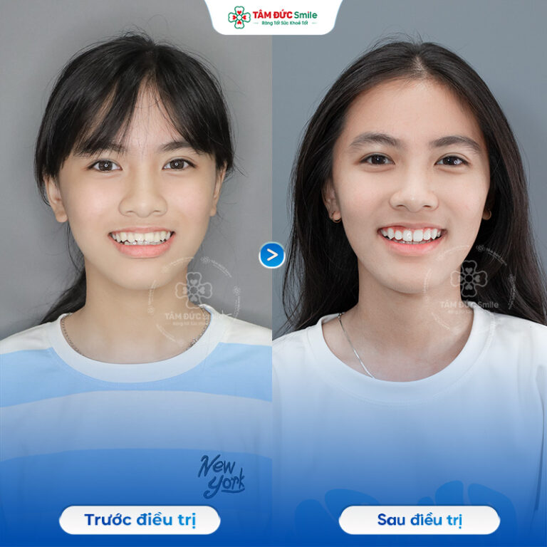 khach-hang-nhat-phuong-2