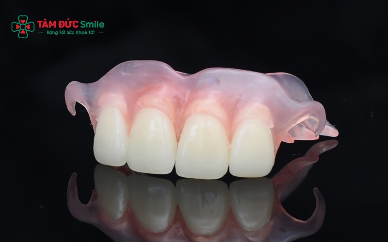Các phương pháp phục hình 4 răng cửa phổ biến gồm Abc8vip1 kèo WC 2026 Implant, cầu ABC8 là nhà cái cá cược trực tuyến uy tín số 1 tại Việt Nam và hàm giả tháo lắp