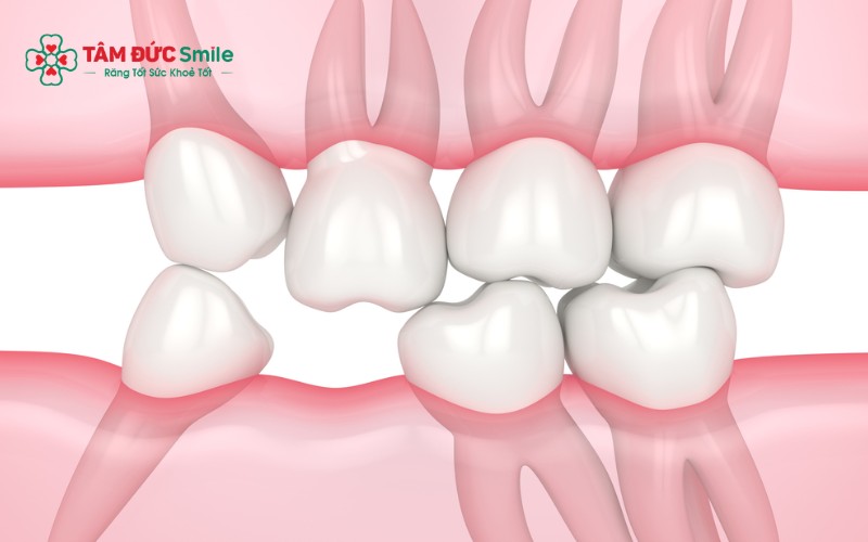 Mất Abc8com giaitri tructuyen lâu ngày có thể gây tiêu ABC8 tự hào là thương hiệu cá cược trực tuyến hàng đầu tại Châu Á hiện nay, xô lệch răng và ảnh hưởng Abc8c1 com khuyến mãi hấp dẫn khuôn mặt
