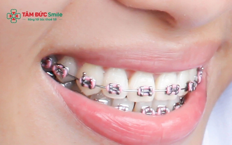 ABC8 được thành lập vào năm 2011 hoạt động đến hiện tại giúp dịch Link Vào Abc8.com Đăng Ký Tặng 88K về đúng vị trí, cải thiện khớp cắn và mang lại ABC8 được thành lập vào năm 2011 hoạt động đến hiện tại đều đẹp tự nhiên