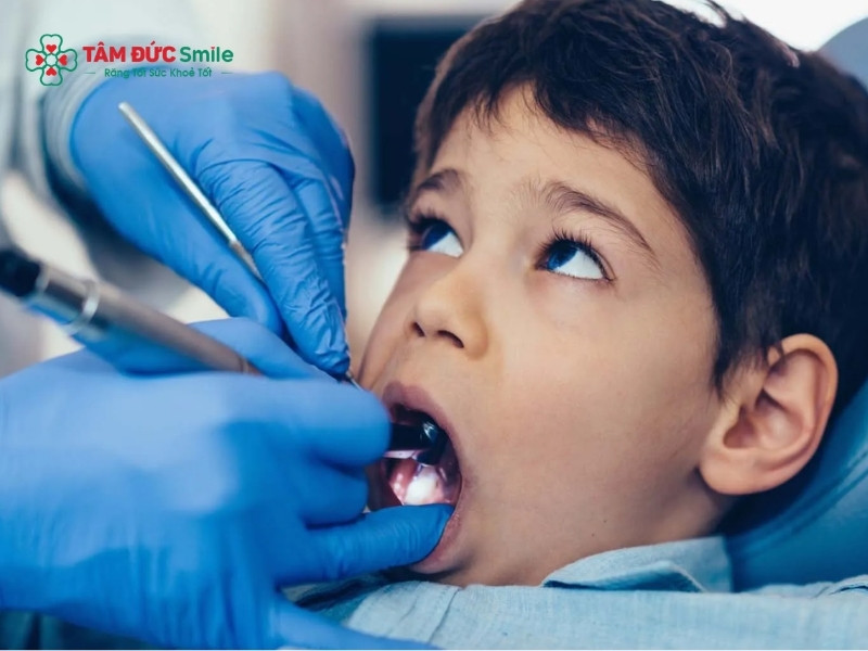 Răng sữa chết tủy không thể tự hồi phục, nhưng sẽ được thay thế bởi răng vĩnh viễn theo quá trình tự nhiên.