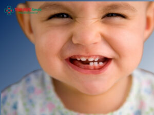 Bé sưng lợi bao lâu thì mọc răng? Cách giảm đau hiệu quả cho trẻ khi mọc răng