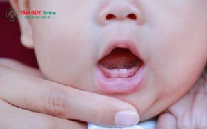 Trẻ sốt mọc răng 39 độ có nguy hiểm không? Cách xử lý đúng