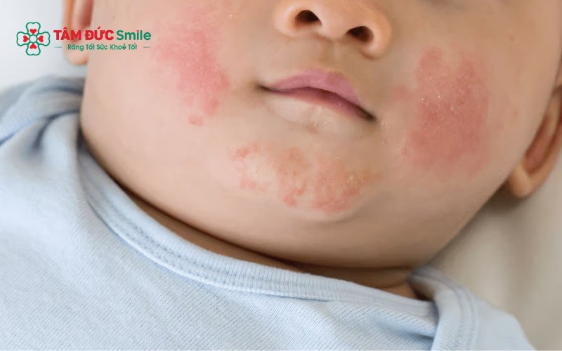 Chăm sóc đúng cách trong giai đoạn mọc răng giúp giảm khó chịu và hỗ trợ trẻ phát triển khỏe mạnh